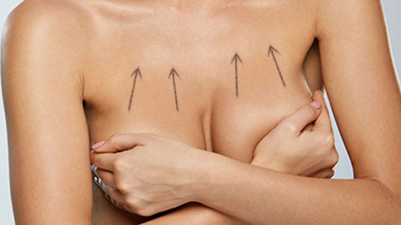 Giá nâng ngực chảy xệ bao nhiêu? Địa chỉ treo sa trễ Việt kiều tin tưởng