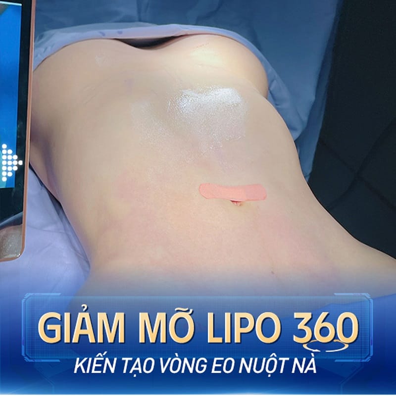 Phương pháp hút mỡ hiện đại sẽ giảm thiểu đau đớn cho khách hàng