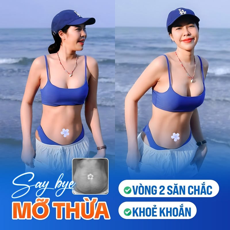 Thân hình thon gọn, quyến rũ sau hút mỡ
