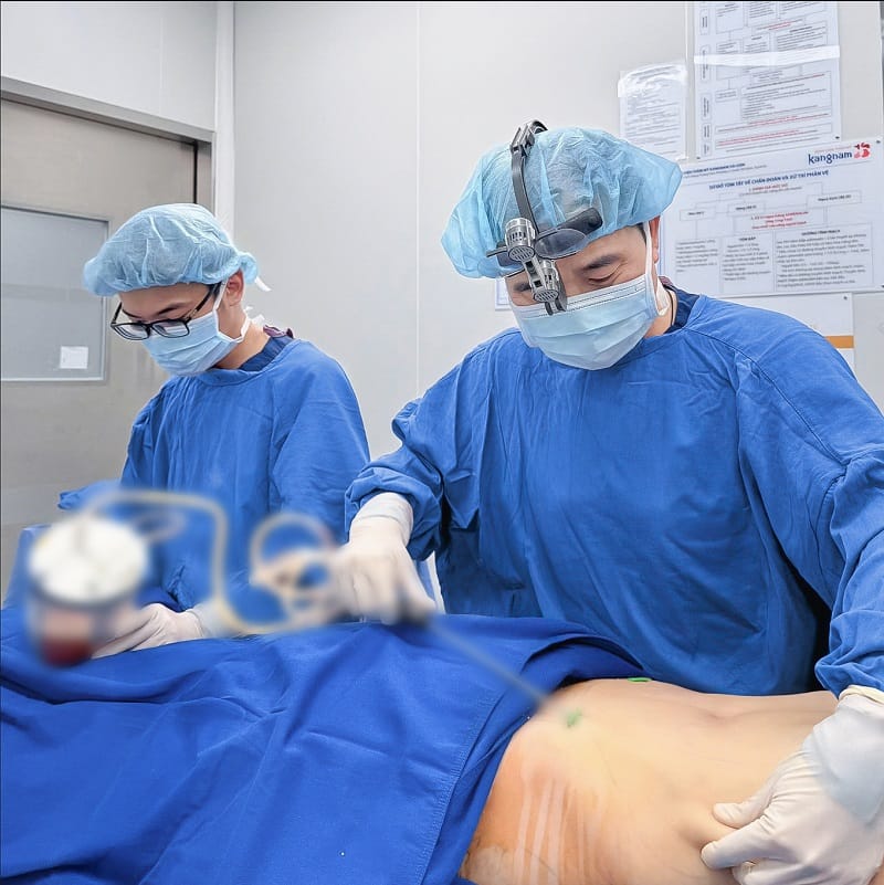 Hút mỡ bụng không cần phẫu thuật sử dụng phương pháp hiện đại để loại bỏ mỡ thừa