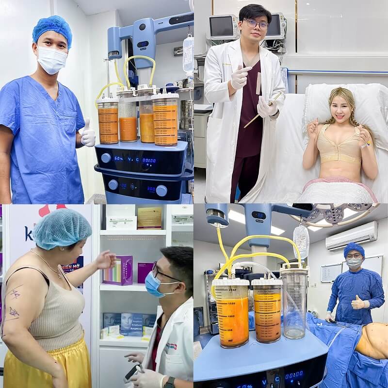 Kangnam thực hiện quy trình hút mỡ bụng chuẩn y khoa, chuyên nghiệp