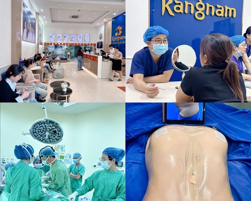 Viện thẩm mỹ Kangnam Đà Nẵng có cơ sở vật chất hiện đại, công nghệ hút mỡ bụng tiên tiến