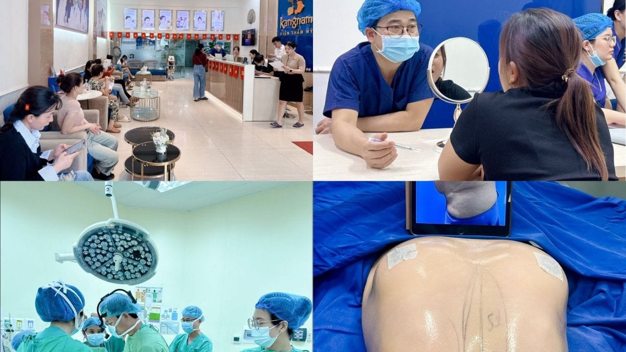Top 5 địa chỉ hút mỡ bụng tại Kangnam uy tín, được khách hàng lựa chọn
