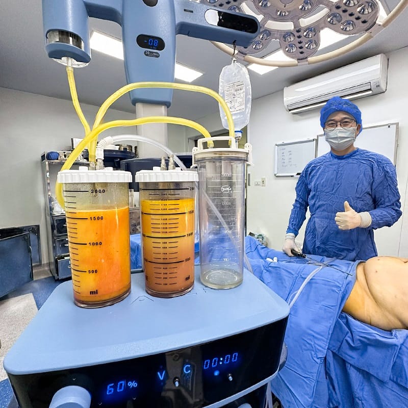 Lựa chọn địa chỉ hút mỡ uy tín giúp đảm bảo an toàn cho khách hàng