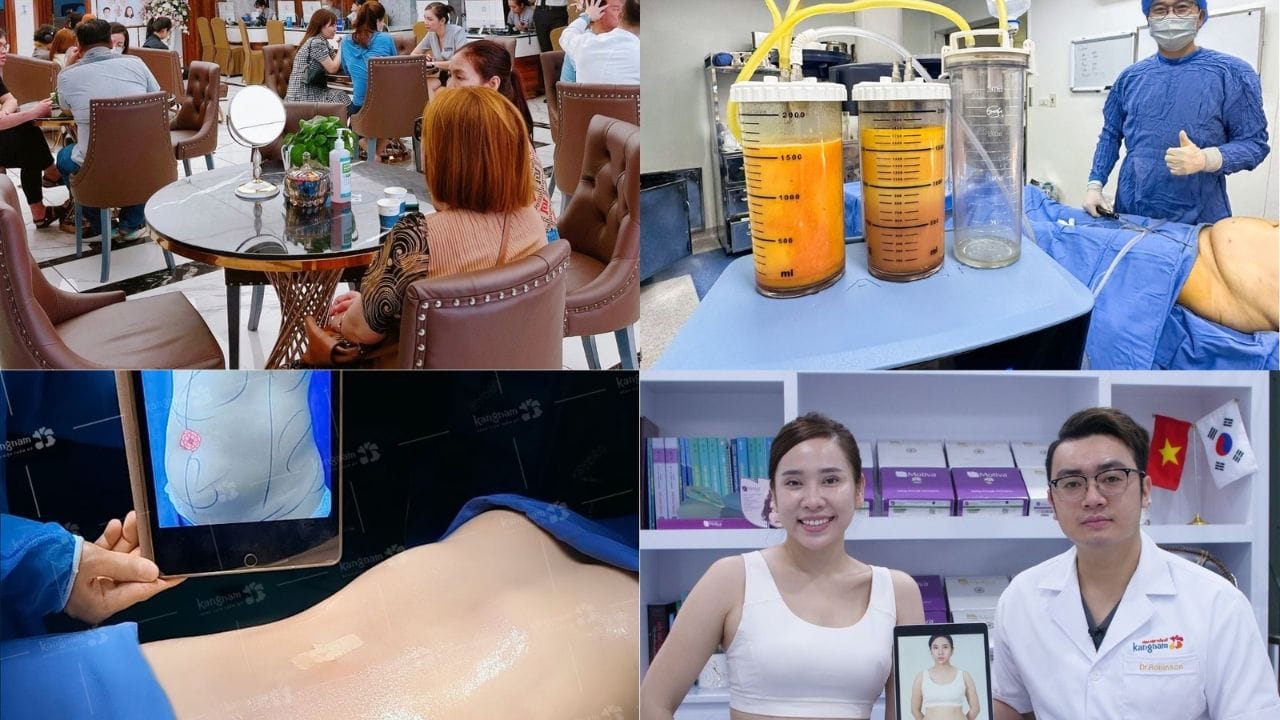 Top 10 địa chỉ hút mỡ uy tín tại Tp.HCM được khách hàng đánh giá