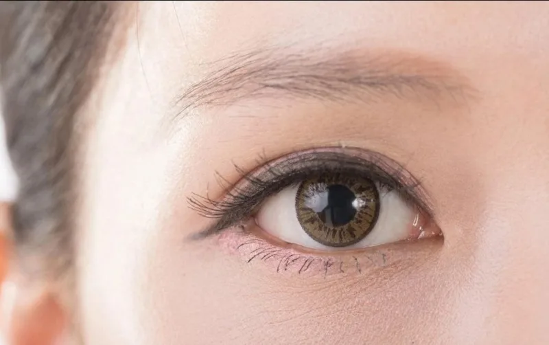 Double eyelids create the appearance of larger, deep-set eyes. 