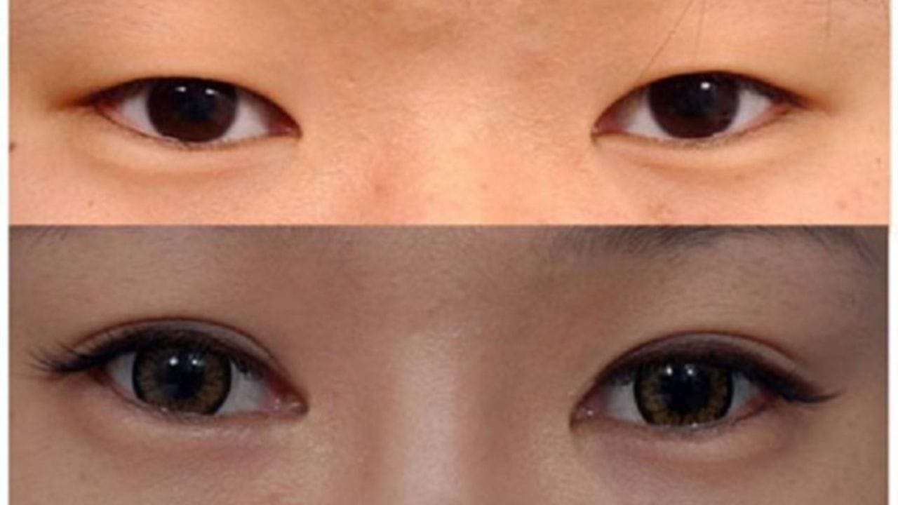 Làm sao để nhận biết mắt 2 mí? Cách sở hữu mắt 2 mí nhanh chóng