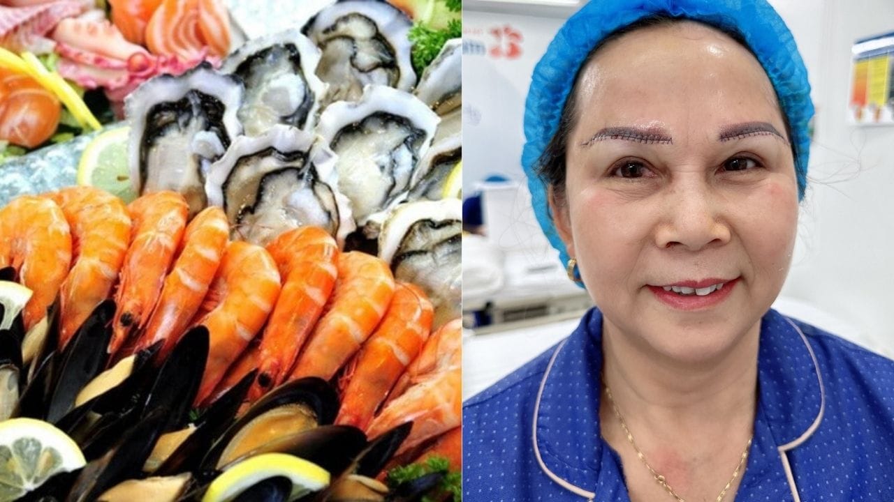 Nâng cung chân mày kiêng hải sản bao lâu và nên ăn gì?