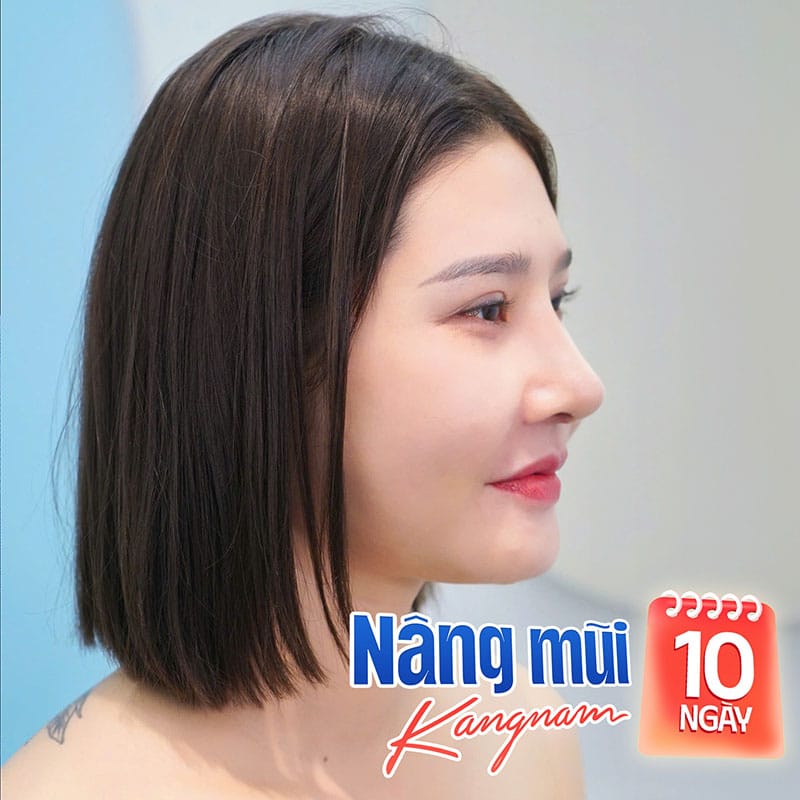 Chăm sóc tốt giúp mũi nhanh lành sau 10 ngày