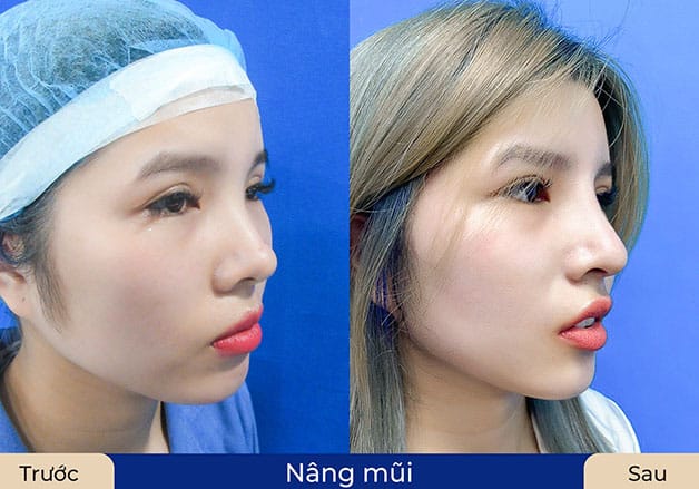 Khách hàng hồi phục nhanh, sở hữu góc nghiêng đỉnh