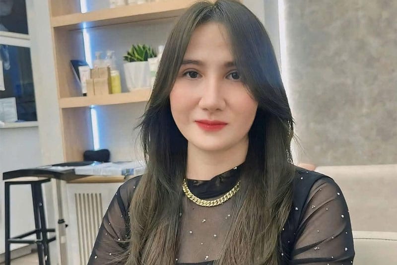 Dáng mũi ổn định sau nhiều năm