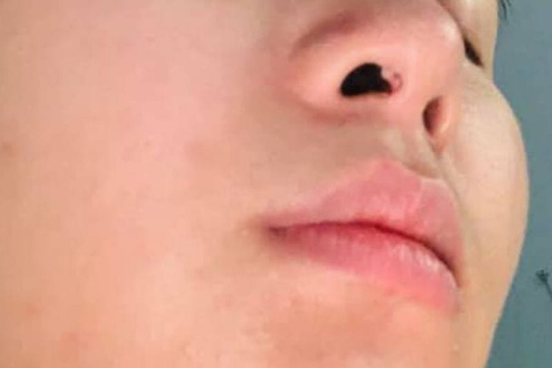 Sụn không tương thích