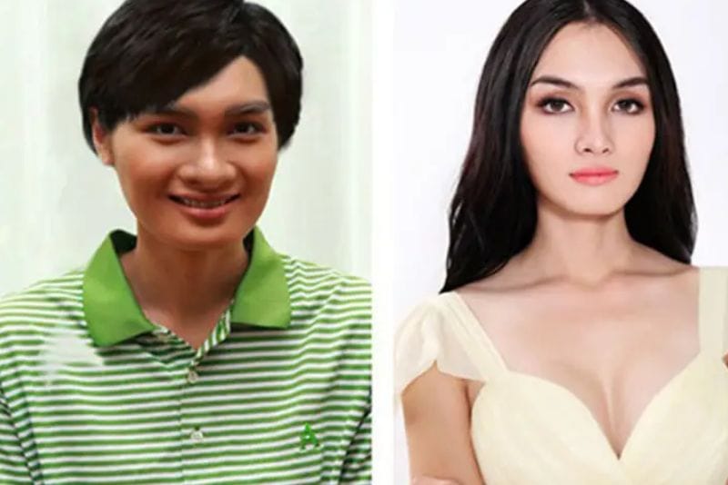 Khẳng định bản dạng giới sau nâng ngực