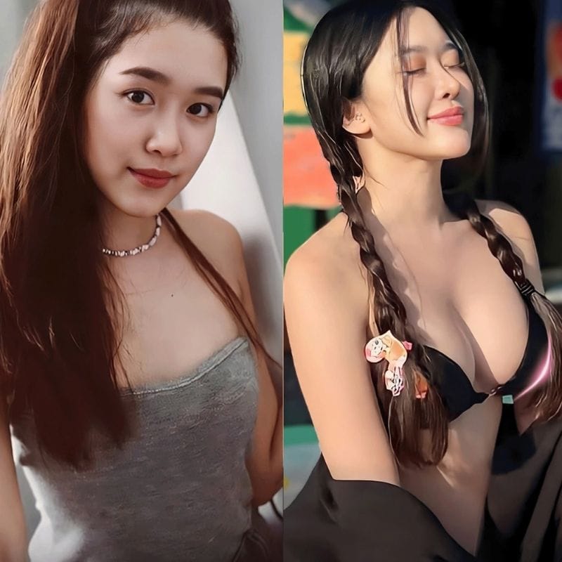 Nâng ngực duy trì lâu dài nhưng không vĩnh viễn