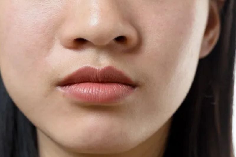 Dáng mũi không cân đối