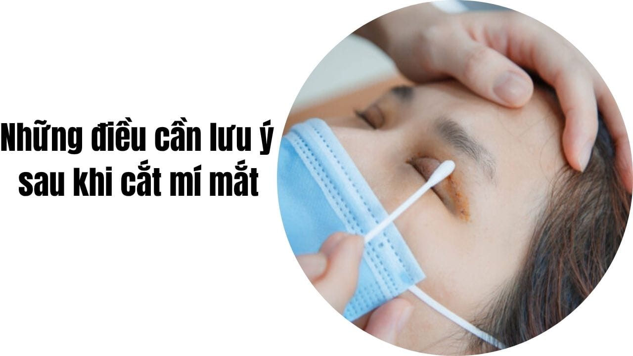 Những điều cần lưu ý sau khi cắt mí mắt mà bạn cần biết