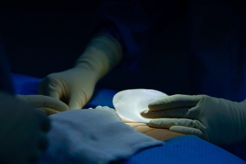 Kangnam áp dụng kỹ thuật nâng ngực nội soi