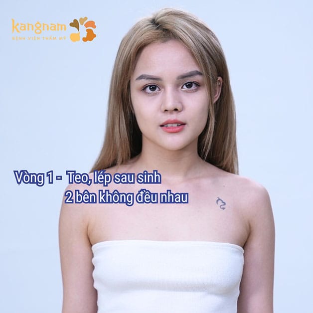 Ngực nhỏ, teo lép khiến phái đẹp thiếu tự tin