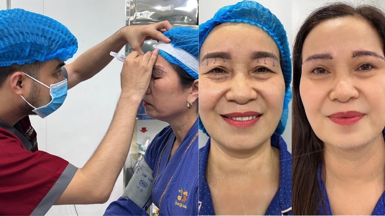 Treo chân mày giá bao nhiêu? bảng giá mới nhất