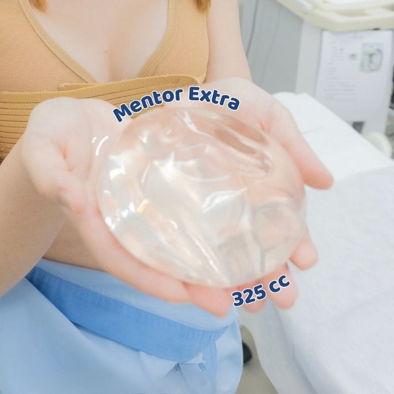 Túi ngực Mentor Extra cao cấp