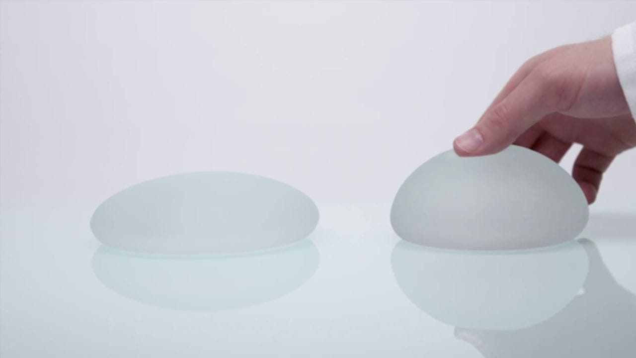 Túi ngực motiva có tốt không? Lý do túi ngực motiva được lựa chọn nhiều