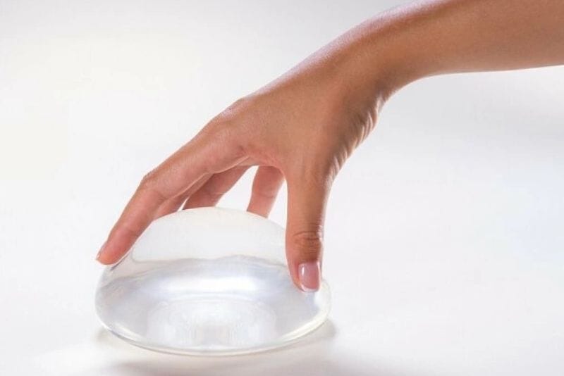 Túi ngực Nagor có chính sách bảo hành lâu dài