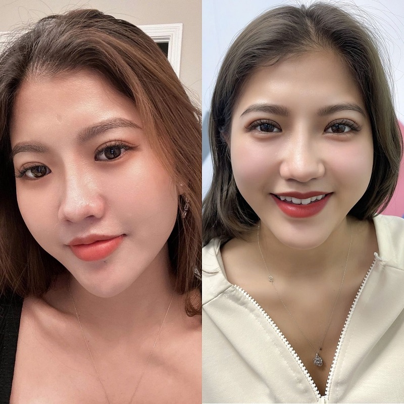 Eyelid surgery provides a comprehensive solution for eyelid concerns.
