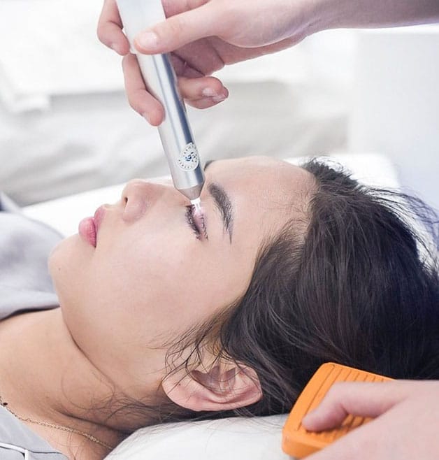 Chiếu tia Plasma giúp mí nhanh lành