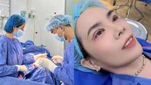 Top 3 Double Eyelid Facilities in Vietnam