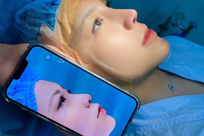 Mũi lên form ngay sau khi vừa thực hiện