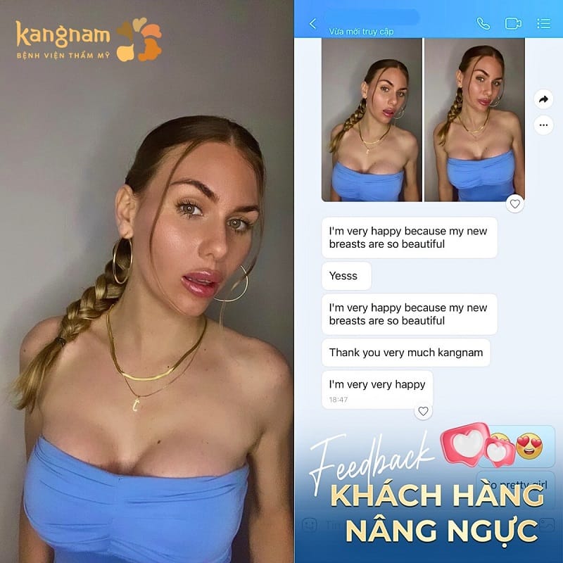 Khách hàng quốc tế phản hồi tích cực sau nâng ngực tại Kangnam