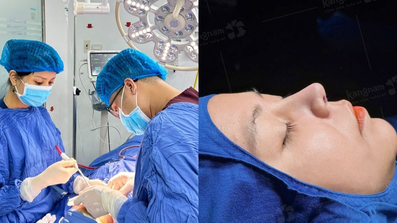 Phẫu thuật bao lâu hồi phục ổn định? Có phù hợp với khách hàng Việt Kiều không?