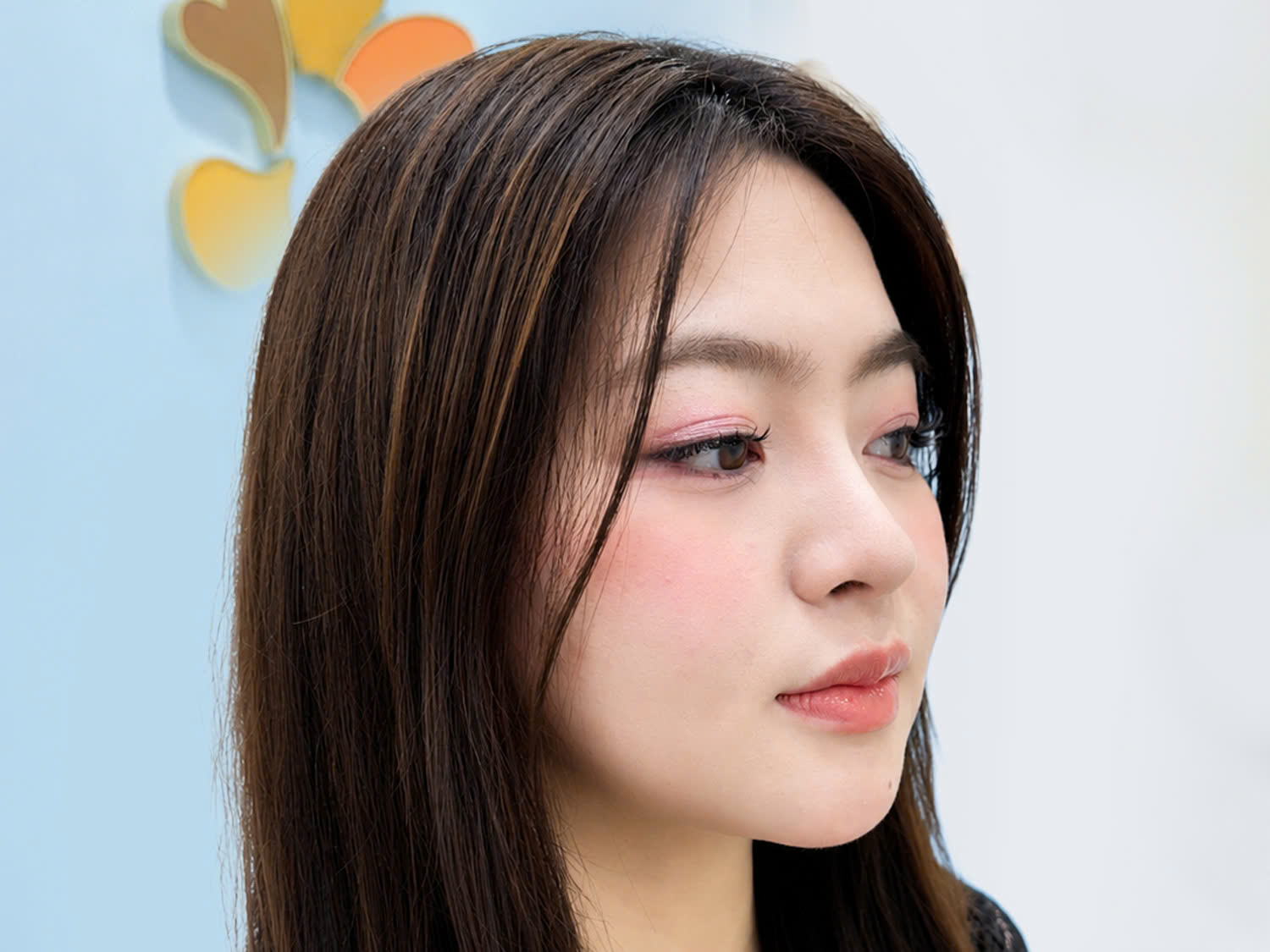 Angeliaca Nguyễn tái khám sau nâng mũi, mũi hồi phục ổn định và vào form nhanh
