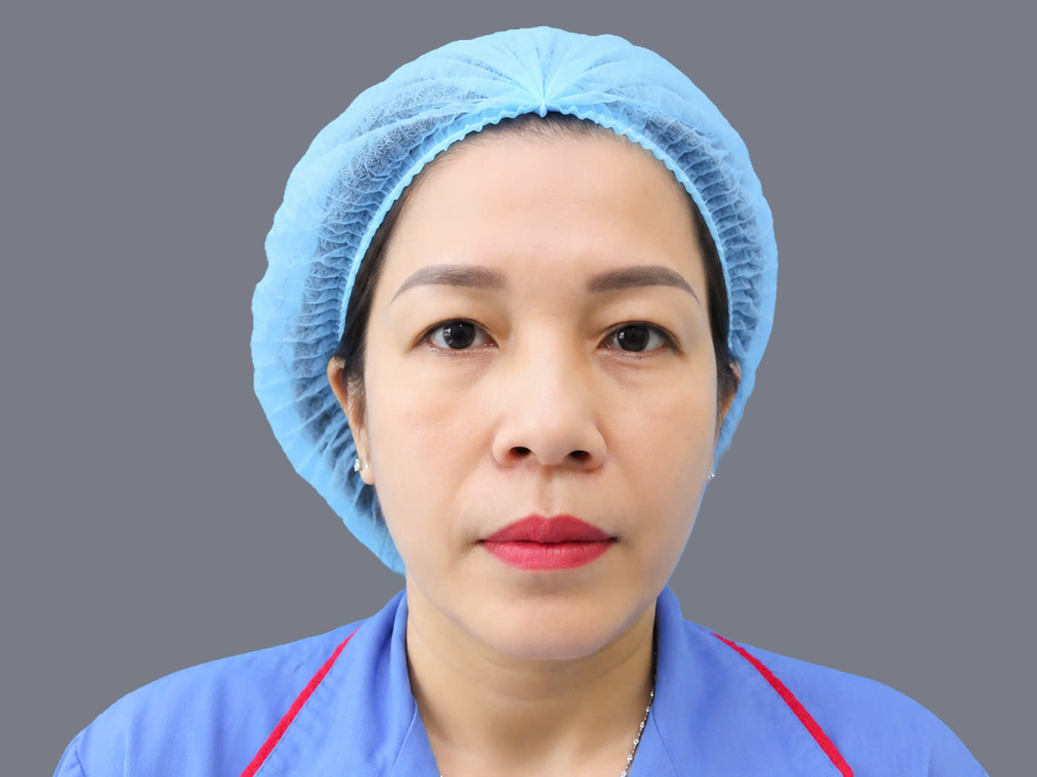 tình trạng khách hàng vùng mí trên ngày càng xuất hiện nhiều da chùng và mỡ thừa