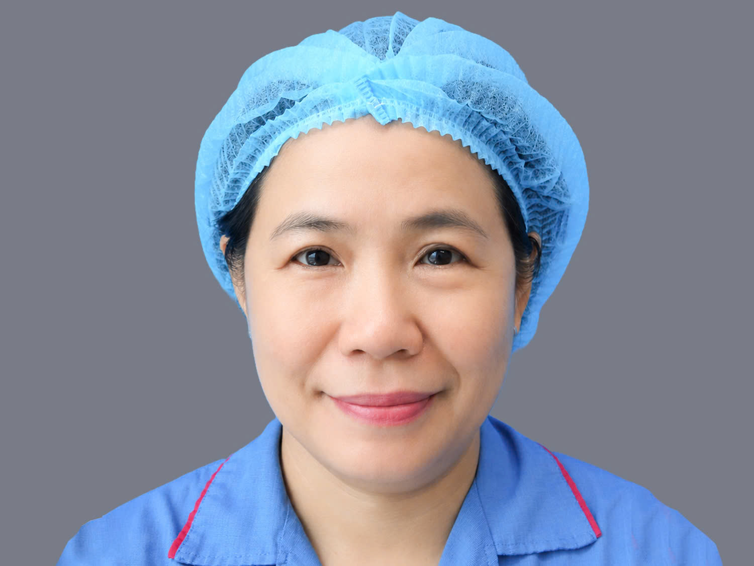 tình trạng mắt nhiều da thừa, mỡ thừa và sụp mí của chị Pauline Phạm