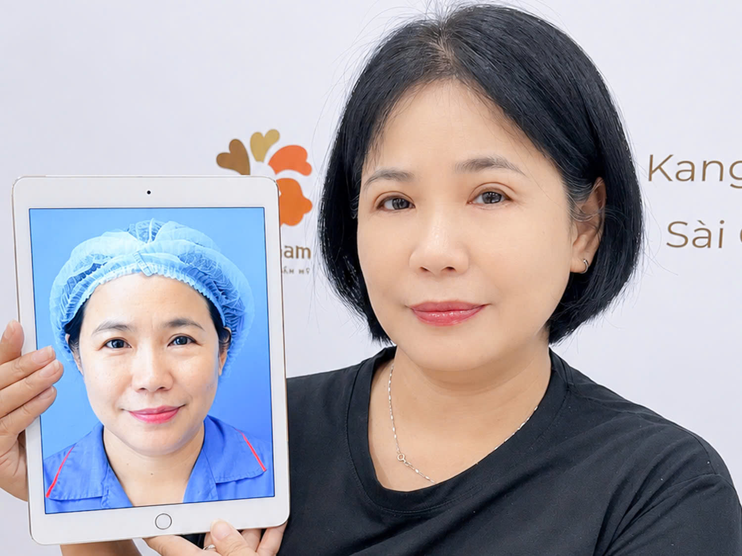 chị Pauline Phạm tự tin hơn sau khi cắt mí tại Kangnam