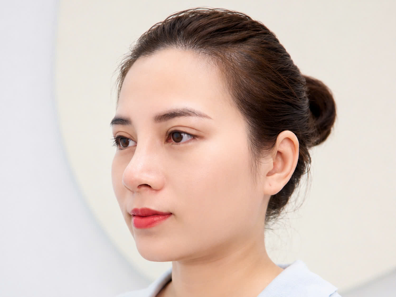 khách hàng Hương Lưu – Việt kiều Thụy Điển sau khi nâng mũi và cắt mí tại Kangnam