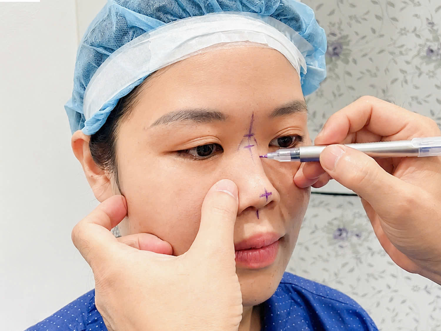 bác sĩ đo vẽ dáng mũi để lên kế hoạch chỉnh sửa cá nhân hóa cho khách hàng Phương Nguyễn