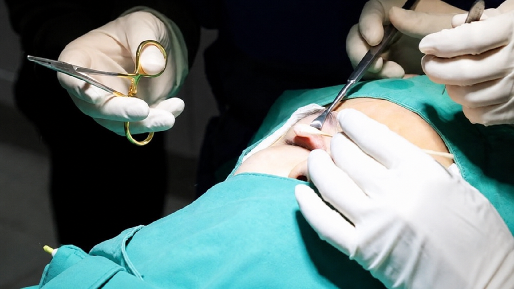 Selecting a reputable eye aesthetic facility