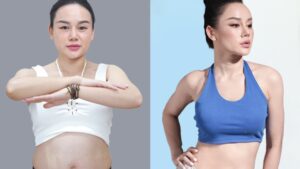 Body Contouring Solutions to Restore Your Figure