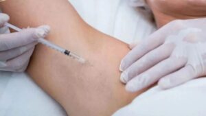 How Much Does Botox for Underarm Odor Cost?