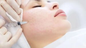 How much does mesotherapy cost? And how many sessions does it take?