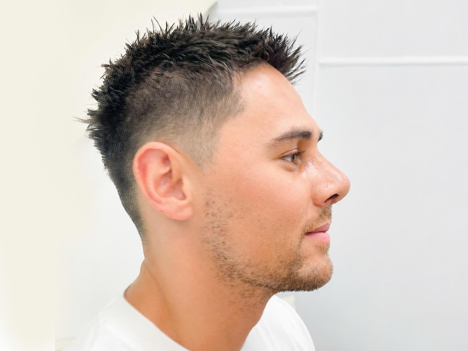 After five days, the swelling in Lemusu's nose had gone down. 