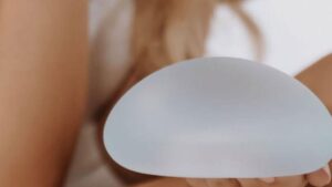 Motiva Breast Implants: Are They Worth It?