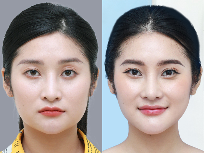 Male and female clients aged 18 and older who meet medical requirements for surgery.