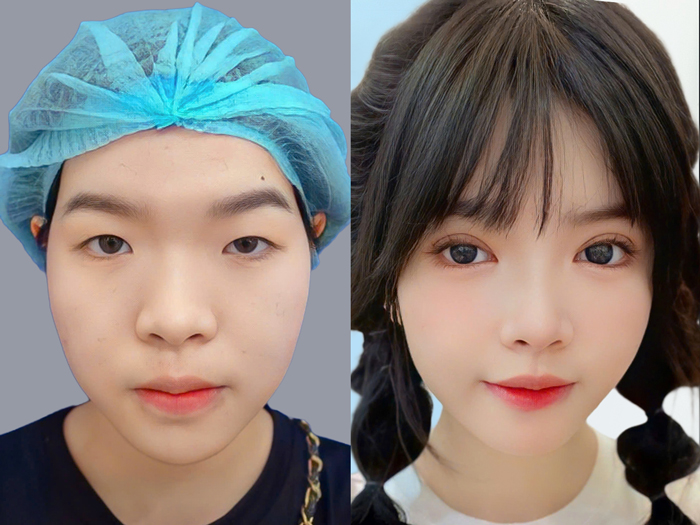 Male client after receiving service at Kangnam, presenting a younger facial appearance