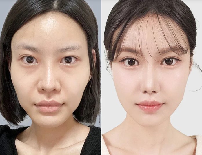 Personalized facial balancing