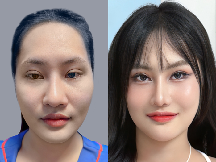 How to identify low cheekbones