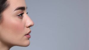 Autologous Cartilage Rhinoplasty: Using Your Own Cartilage
