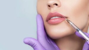 Top 7 Most Beautiful Lip Filler Shapes